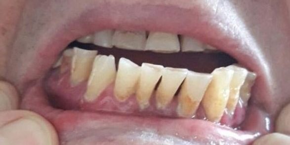 טיפול שיניים בבאר שבע